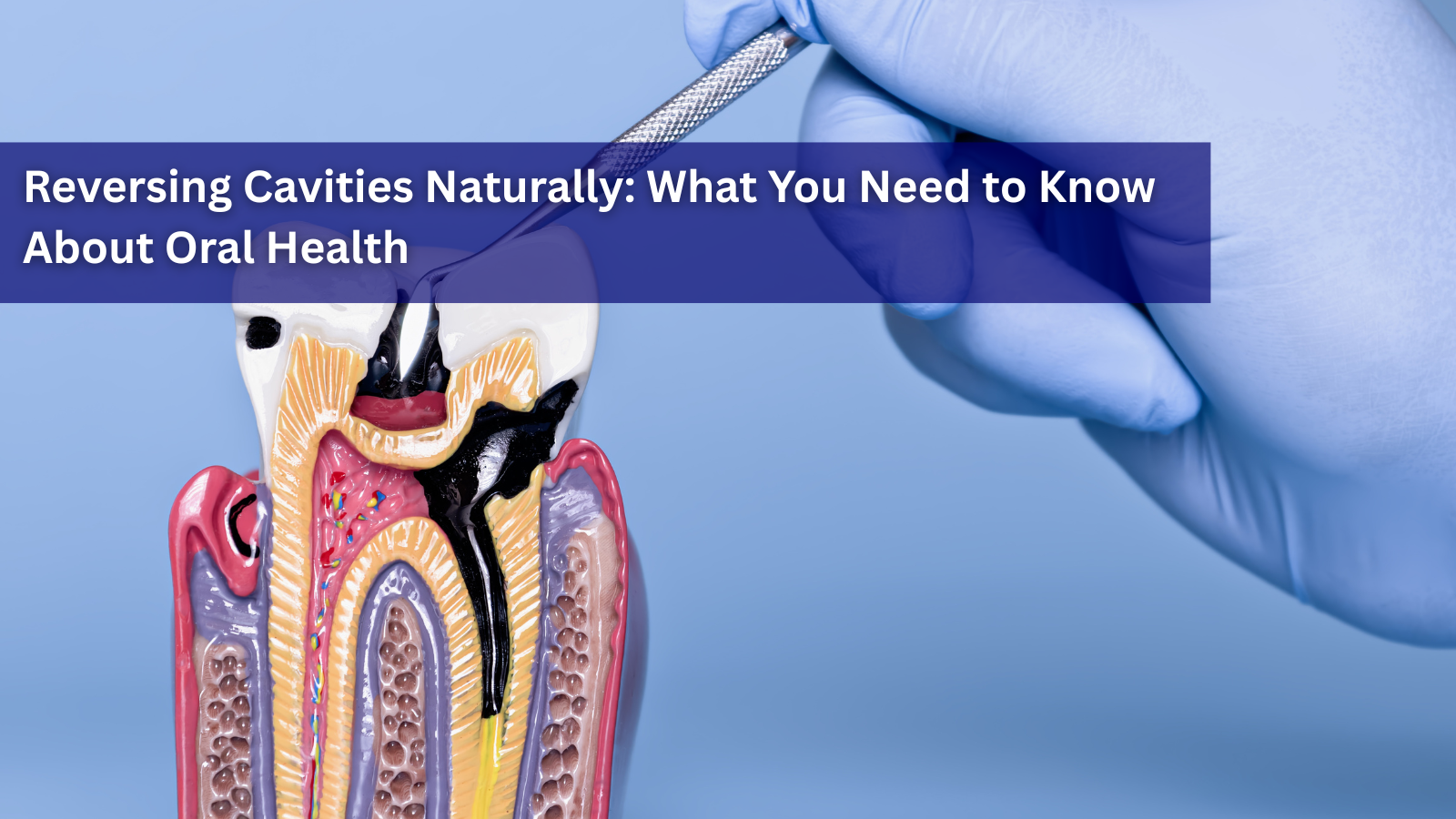 Reversing Cavities Naturally: What You Need to Know About Oral Health
