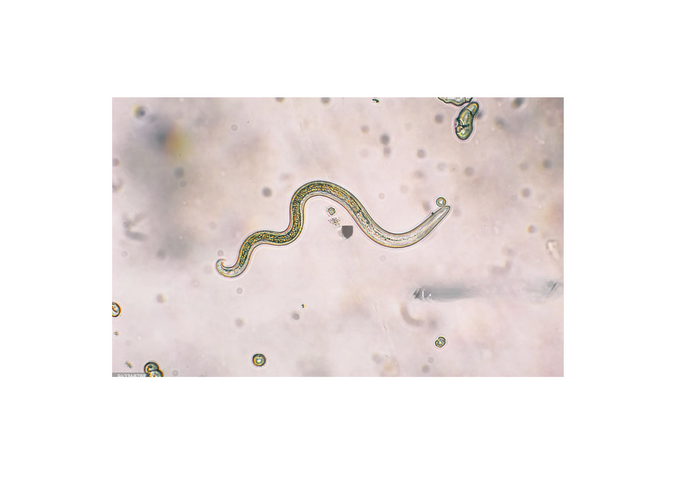 Signs Your Parasite Cleanse Is Working