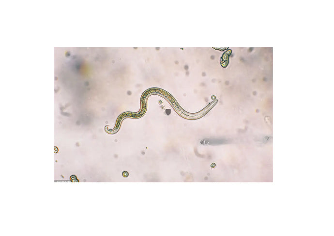 Signs Your Parasite Cleanse Is Working