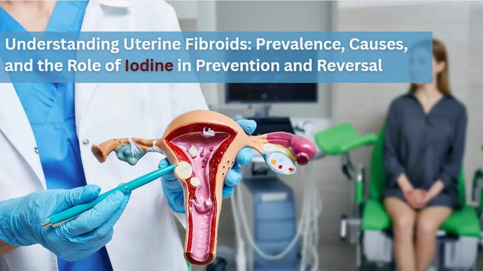 Understanding Uterine Fibroids: Prevalence, Causes, and the Role of Iodine in Prevention and Reversal