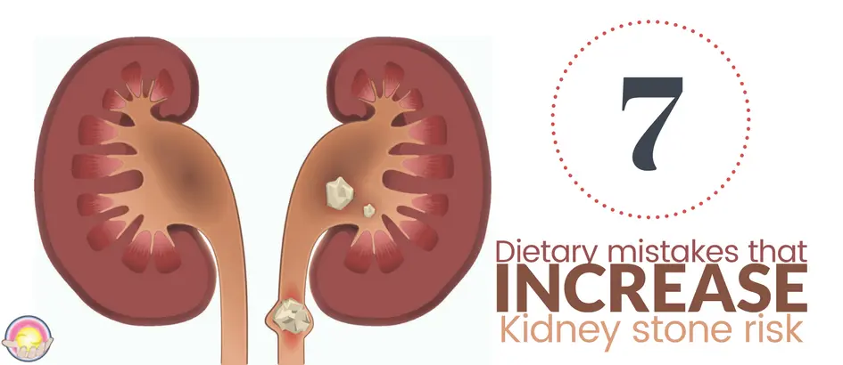 7 Dietary Mistakes that Increase Kidney Stone Risk Dr. Clark Store
