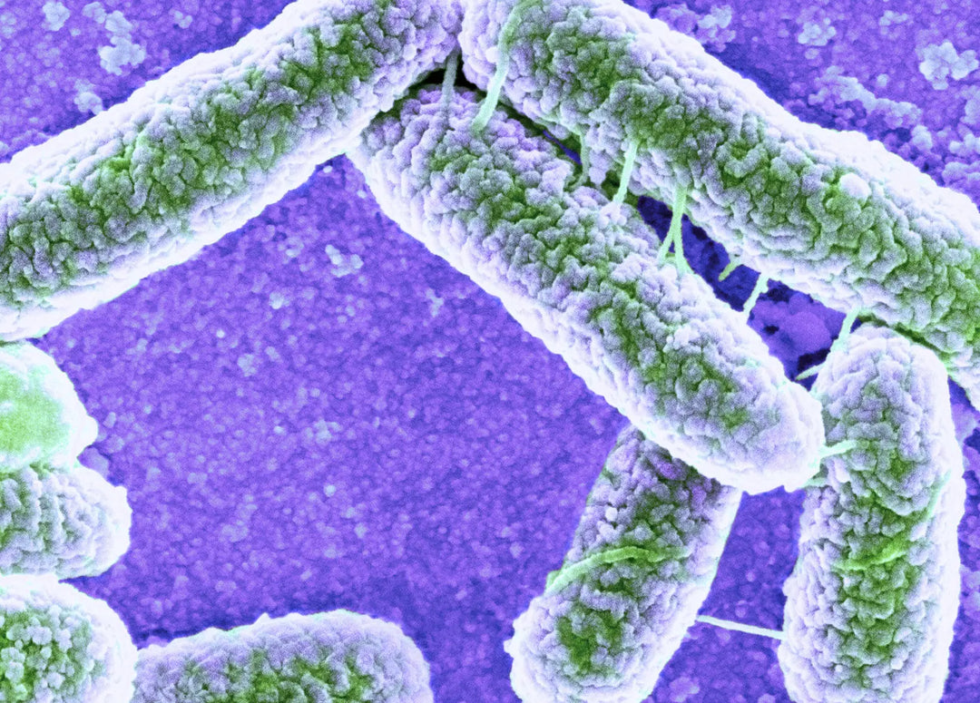 Major-Recall-Alert-as-Carrots-from-Trader-Joe-s-Whole-Foods-and-Ralphs-Kroger-Linked-to-E.-coli-Outbreak Dr. Clark Store